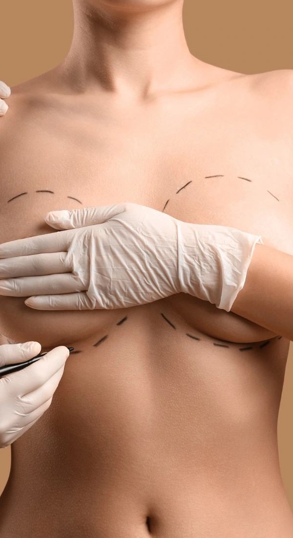 Implantats Austausch Brust