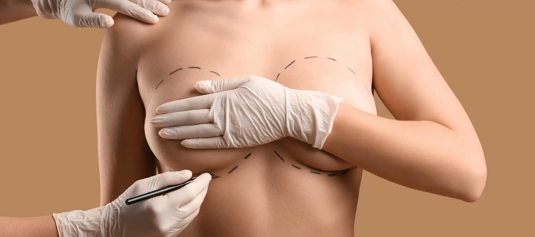 Brustvergrößerung